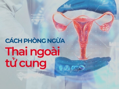 CÁCH PHÒNG NGỪA THAI NGOÀI TỬ CUNG TÁI PHÁT